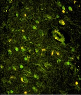 Rabbit Polyclonal Antibody to KHSRP (N-term)