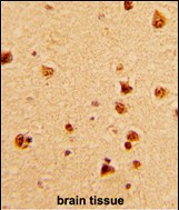 Rabbit Polyclonal Antibody to KHSRP (N-term)