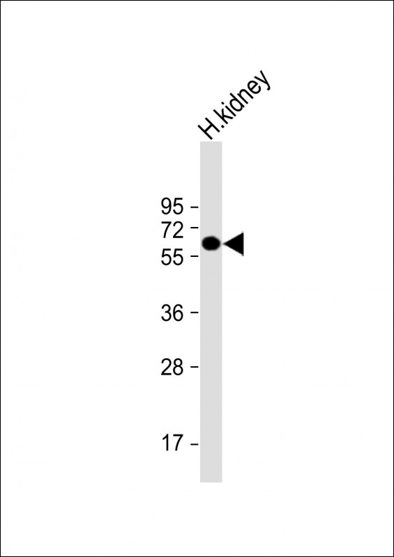 ETFDH (N-term)