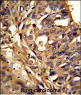 Rabbit Polyclonal Antibody to ETFDH (N-term)