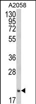 Rabbit Polyclonal Antibody to FTH1