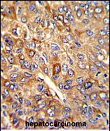 Rabbit Polyclonal Antibody to FTH1