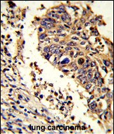 Rabbit Polyclonal Antibody to LUC7L