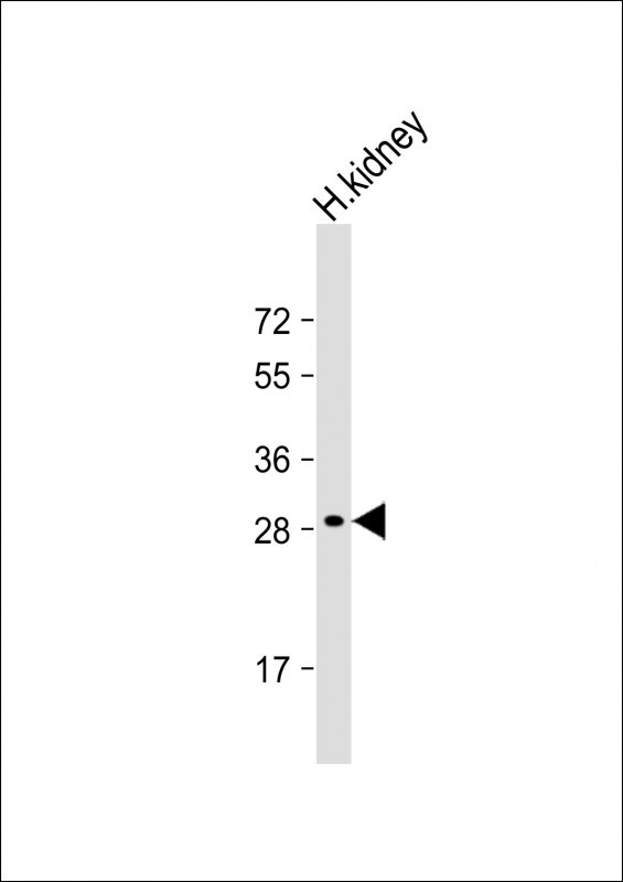 DIO1 (N-term)