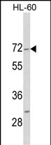 Rabbit Polyclonal Antibody to HIPK4