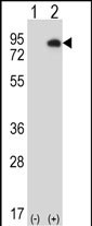 Rabbit Polyclonal Antibody to HIPK4