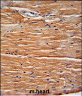 Rabbit Polyclonal Antibody to GIT1