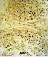 Rabbit Polyclonal Antibody to IMP4