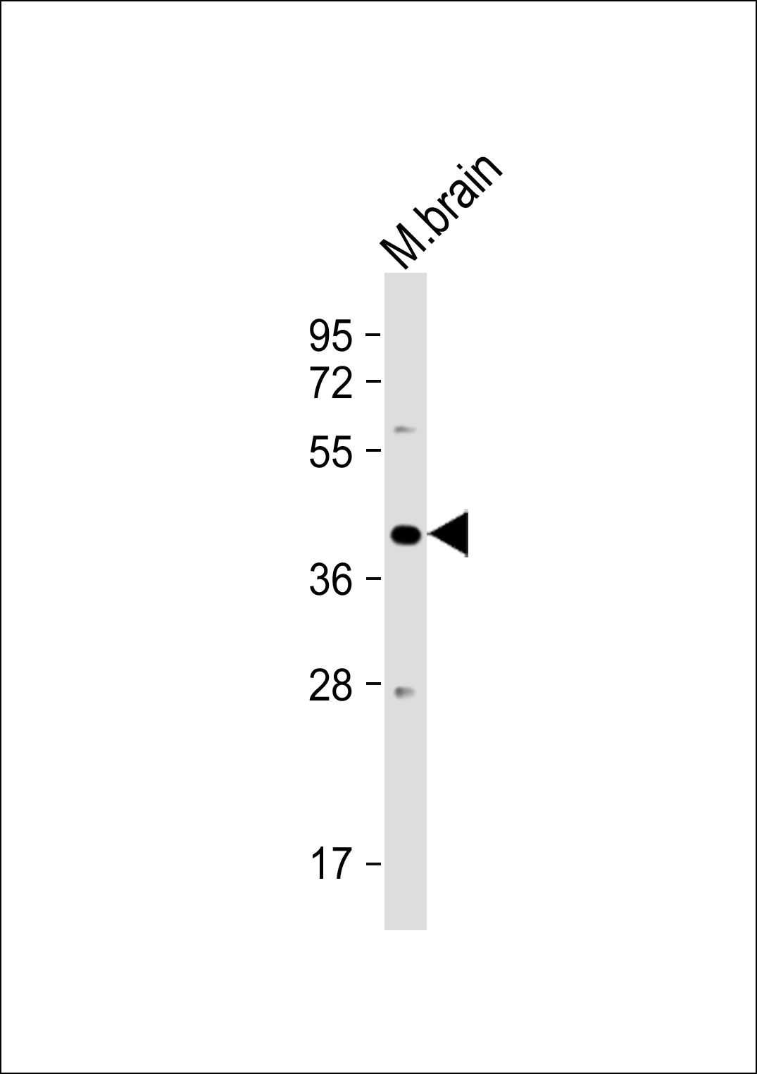 Rabbit Polyclonal Antibody to PSG3 (N-term)