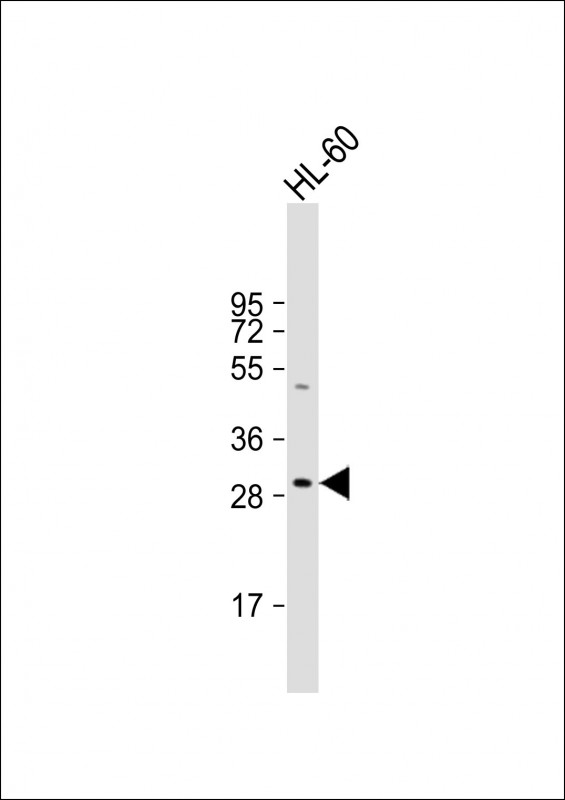 HLA-DRB5