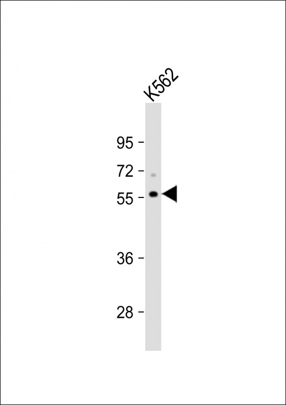 ICB1