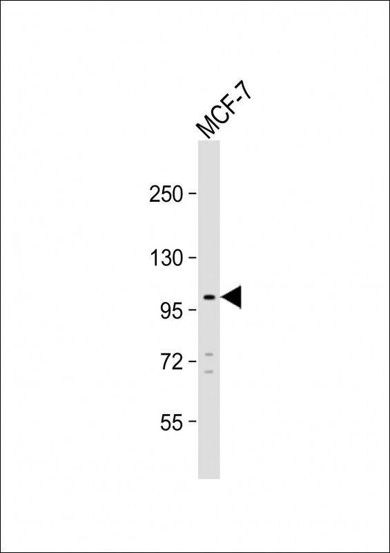 TTC16 (N-term)
