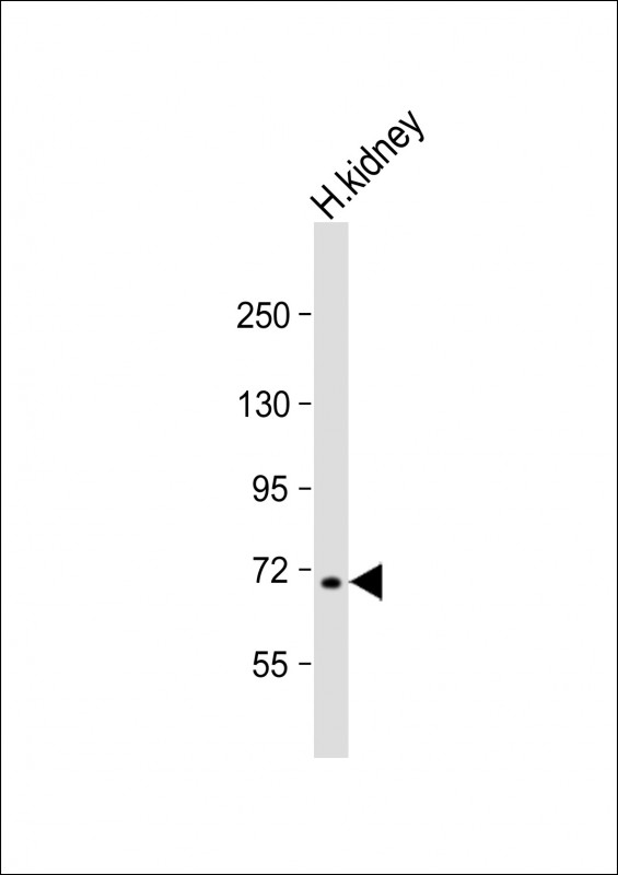 MLL5 (N-term)