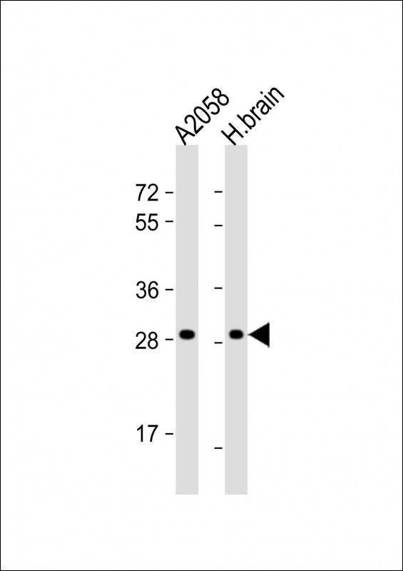 OR4F17 (N-term)