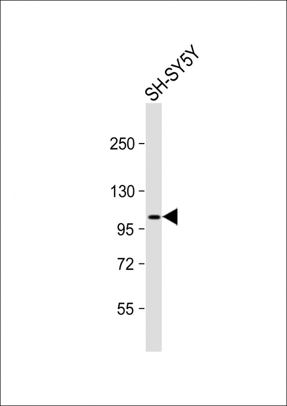 Metabotropic Glutamate Receptor 7 (GPRC1G)