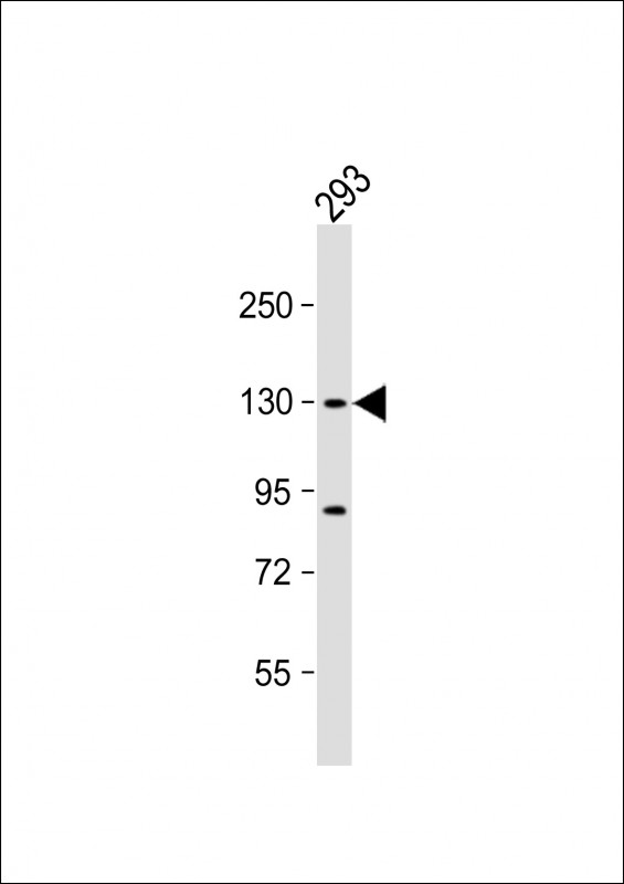DHX30 (N-term)