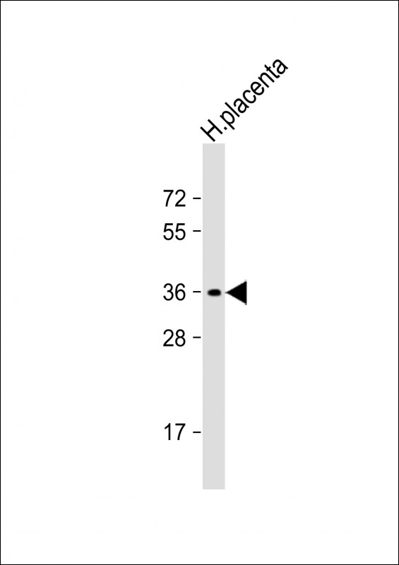 OR8A1(N-term)