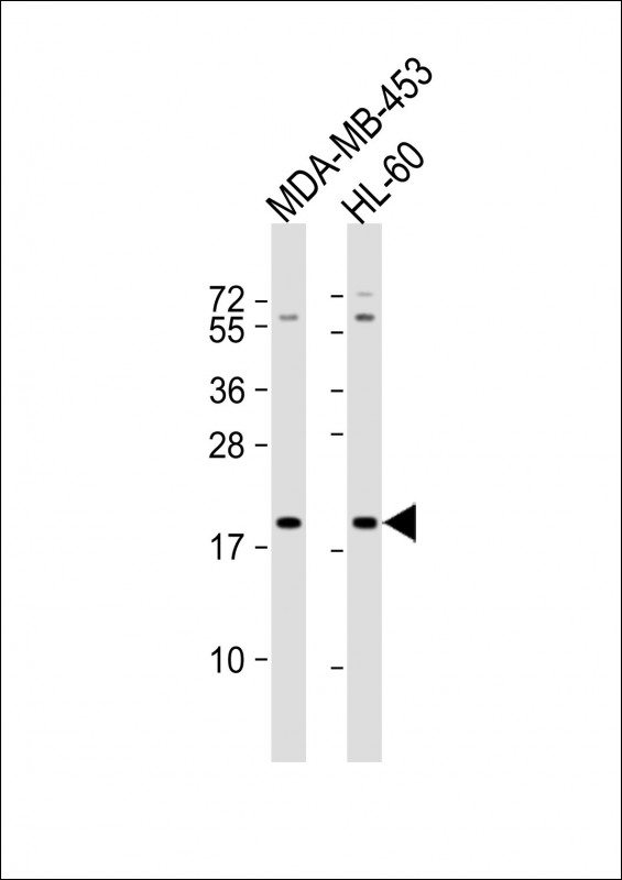 ZNF740 (N-term)