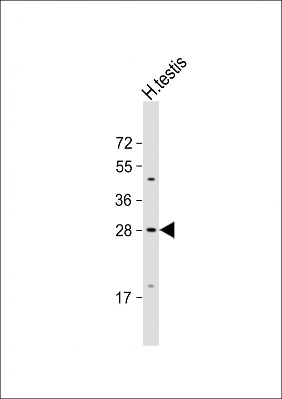 CXorf41