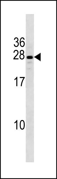 Rabbit Polyclonal Antibody to CXorf41