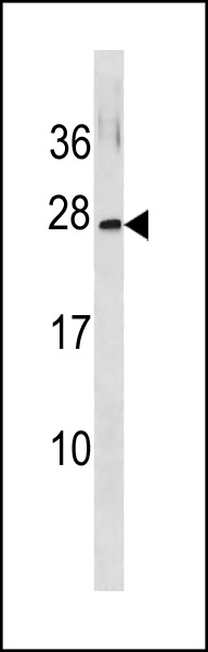 Rabbit Polyclonal Antibody to GINS3