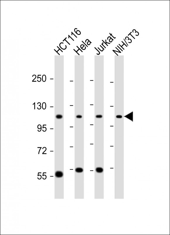 PRPF6 (N-term)