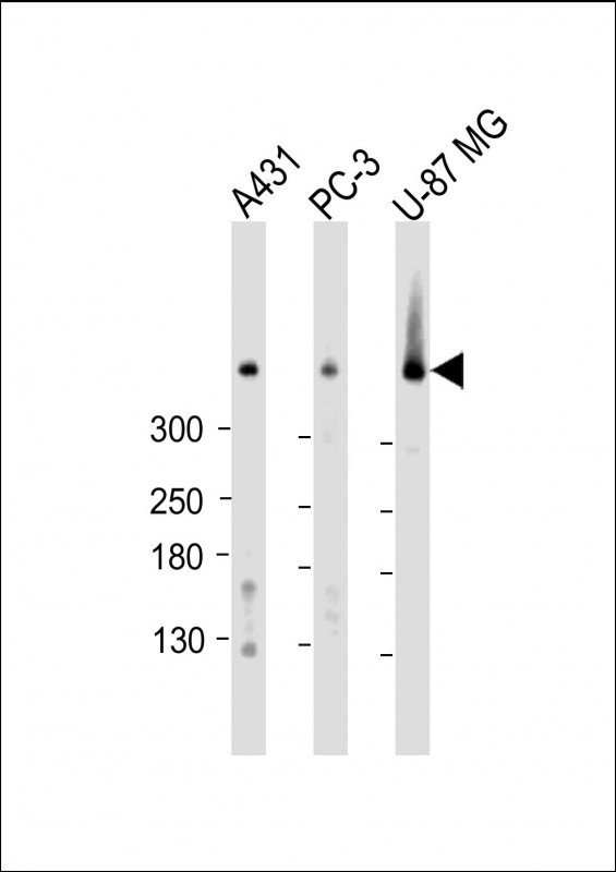 DYNC1H1
