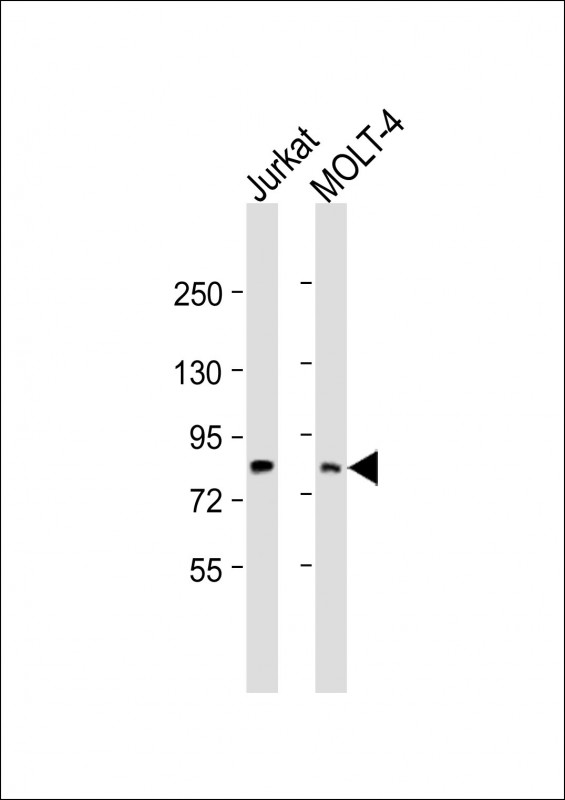 LCP2