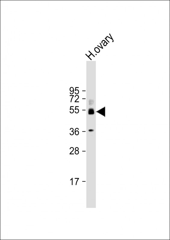 SH3BP5 (N-Term)