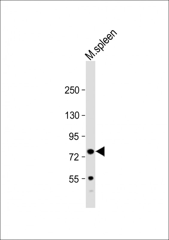 FERMT3 (N-Term)