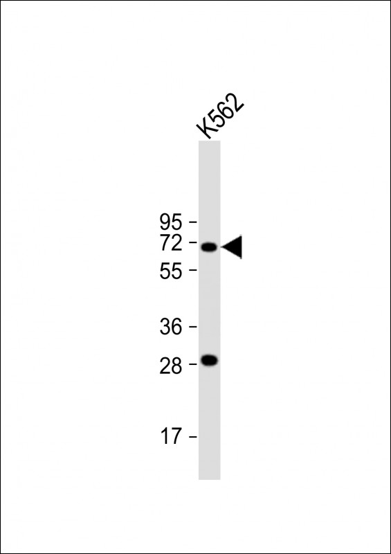 STT3A