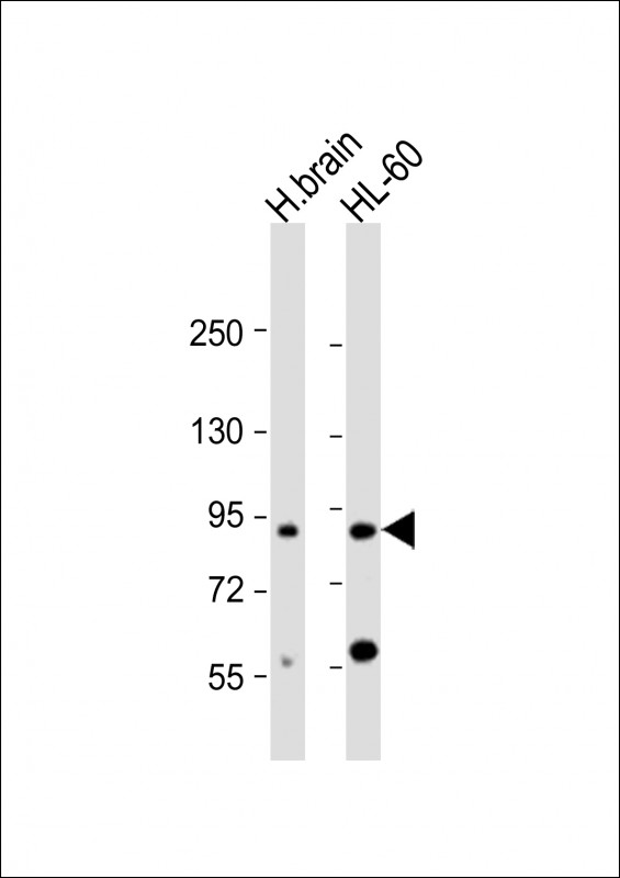 CCDC144A