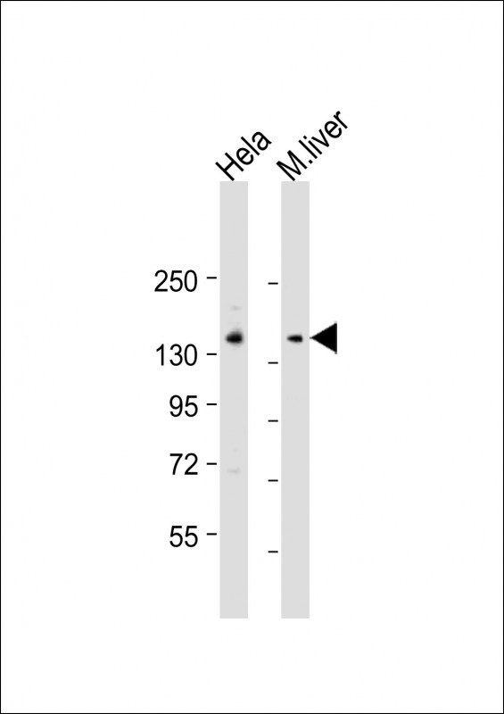 LMTK3 (N-term)