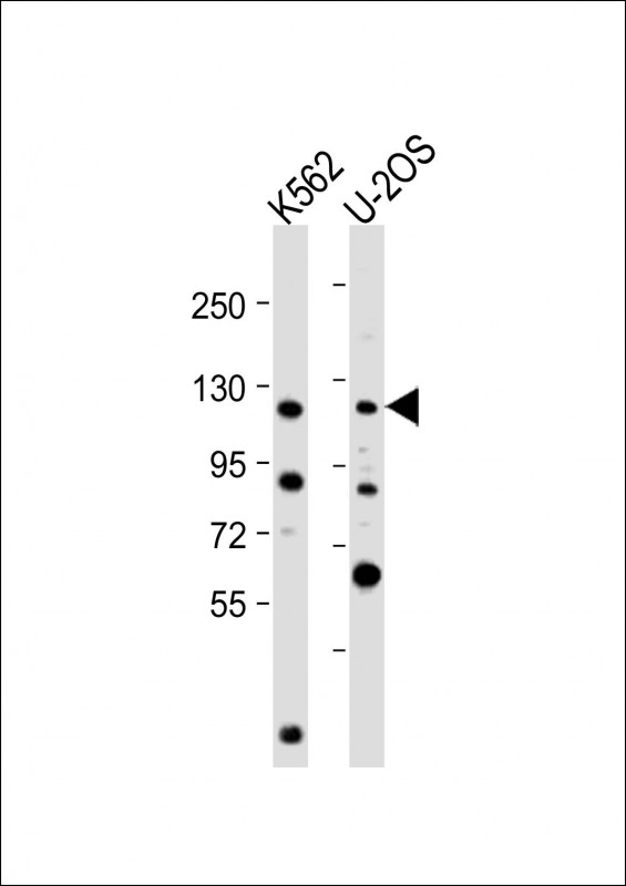NOP2 (N-Term)