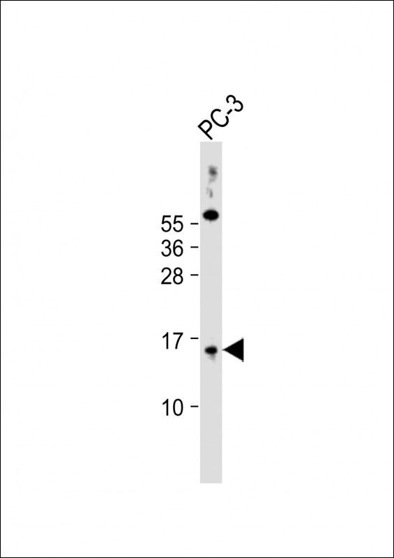 SYNJ2BP (N-Term)