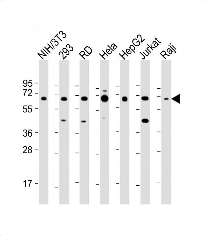 IGF2BP1
