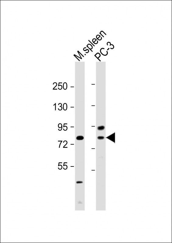 SYVN1 (HRD1)