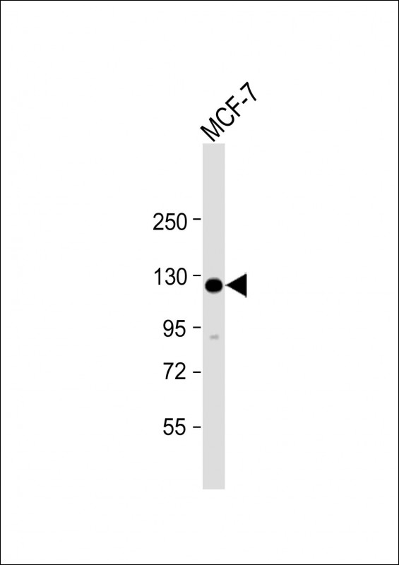 HEATR6 (N-Term)