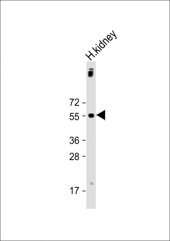 UGT1A9