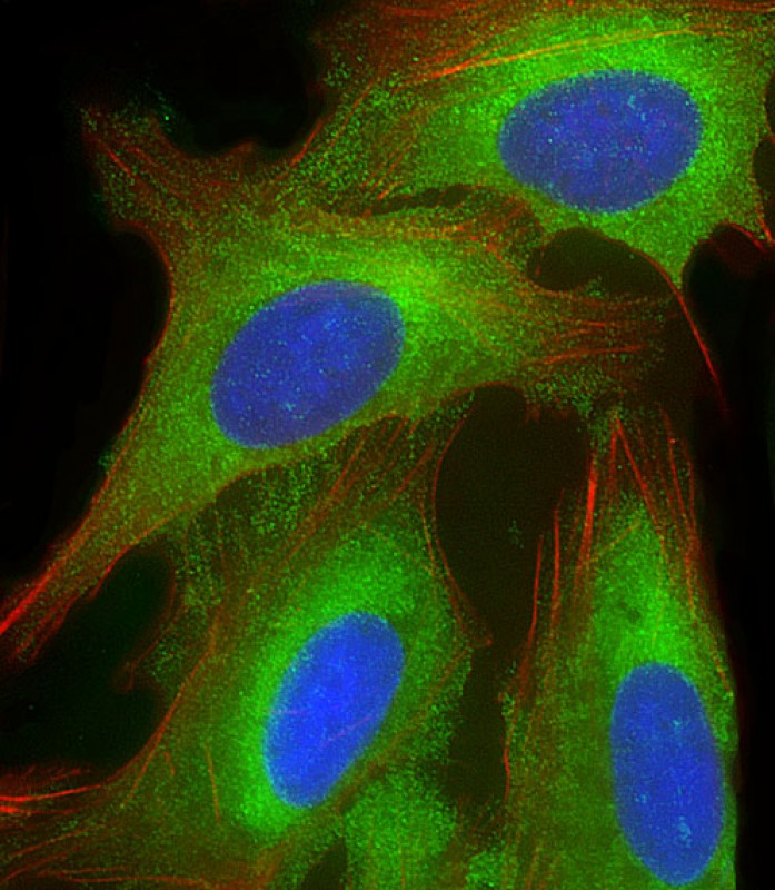 Rabbit Polyclonal Antibody to EEF1A1P5
