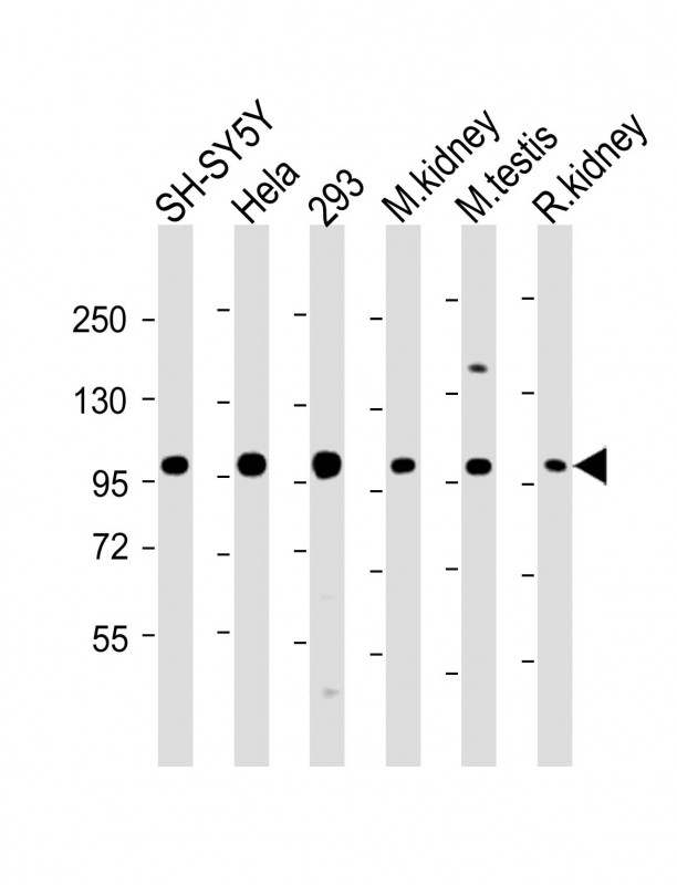 PGAP1 (N-Term)