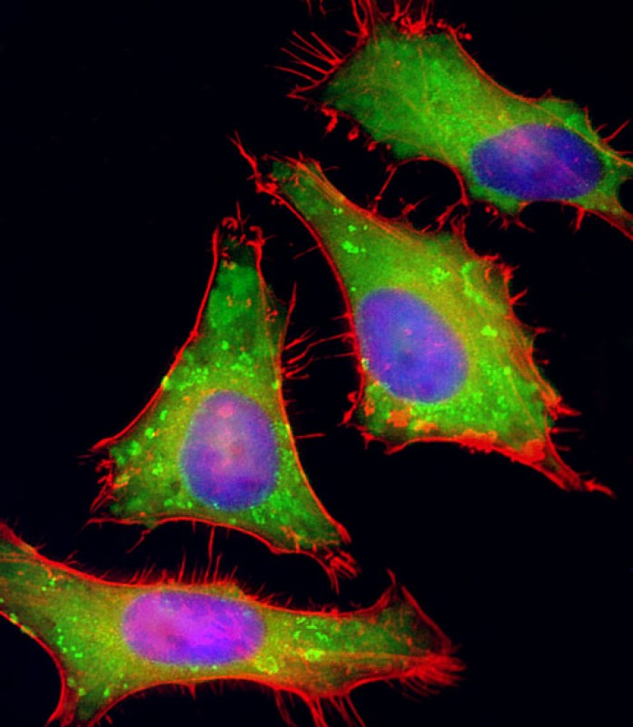 Rabbit Polyclonal Antibody to PGAP1 (N-Term)