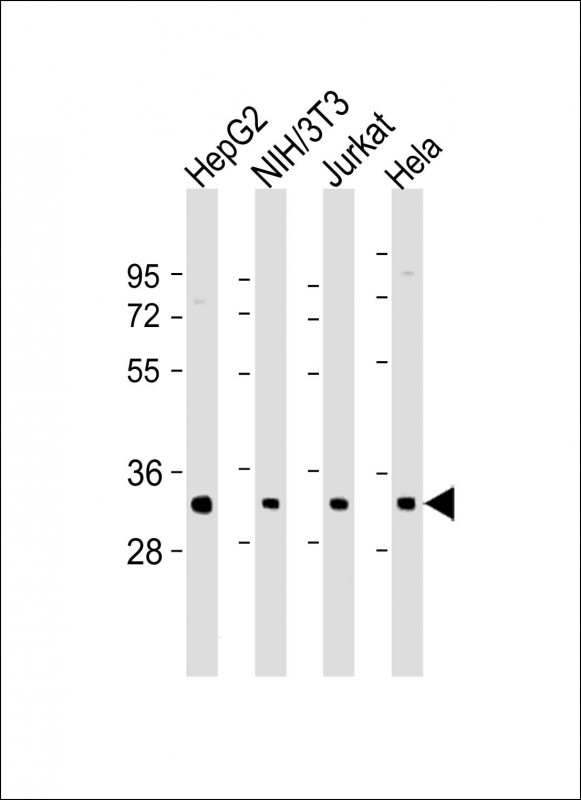 RPS2 (N-Term)