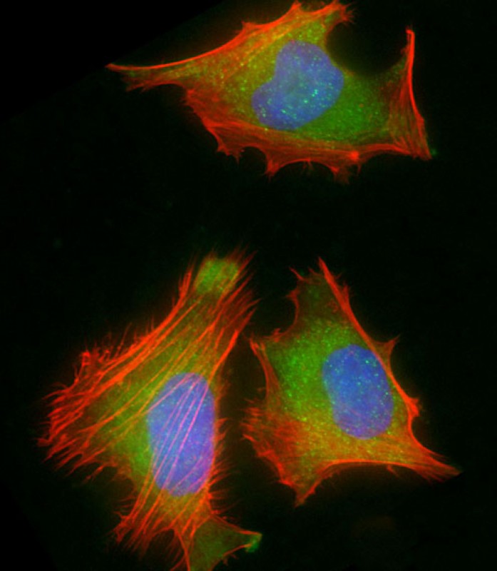 Rabbit Polyclonal Antibody to RPS2