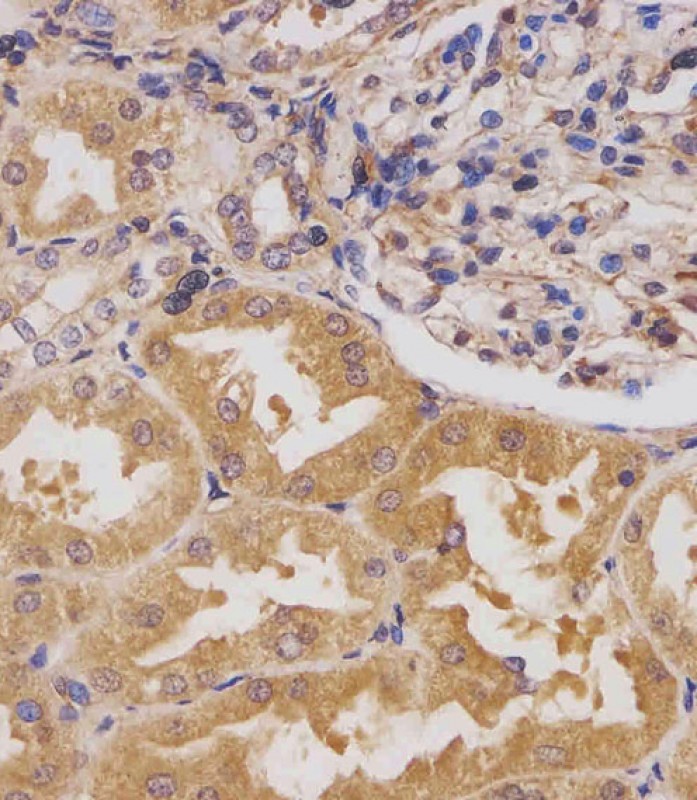 Rabbit Polyclonal Antibody to HIPK3