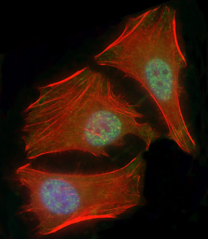 Mouse Monoclonal Antibody to SMAD1