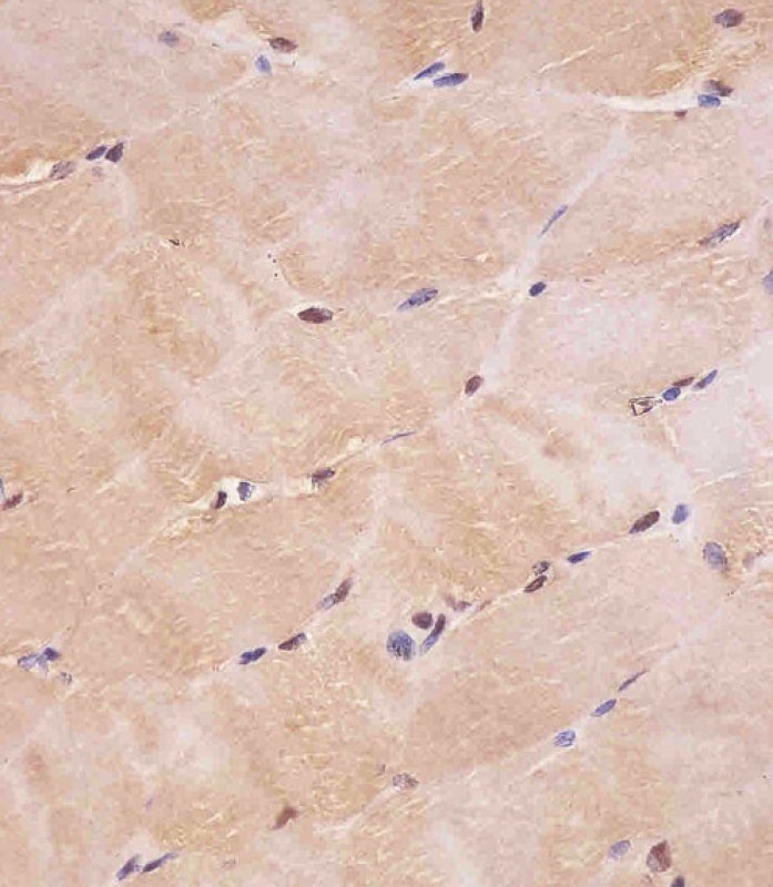 Mouse Monoclonal Antibody to SMAD1