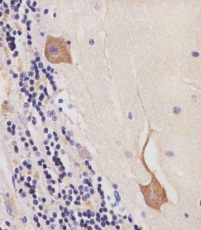 Mouse Monoclonal Antibody to CAMK2 beta