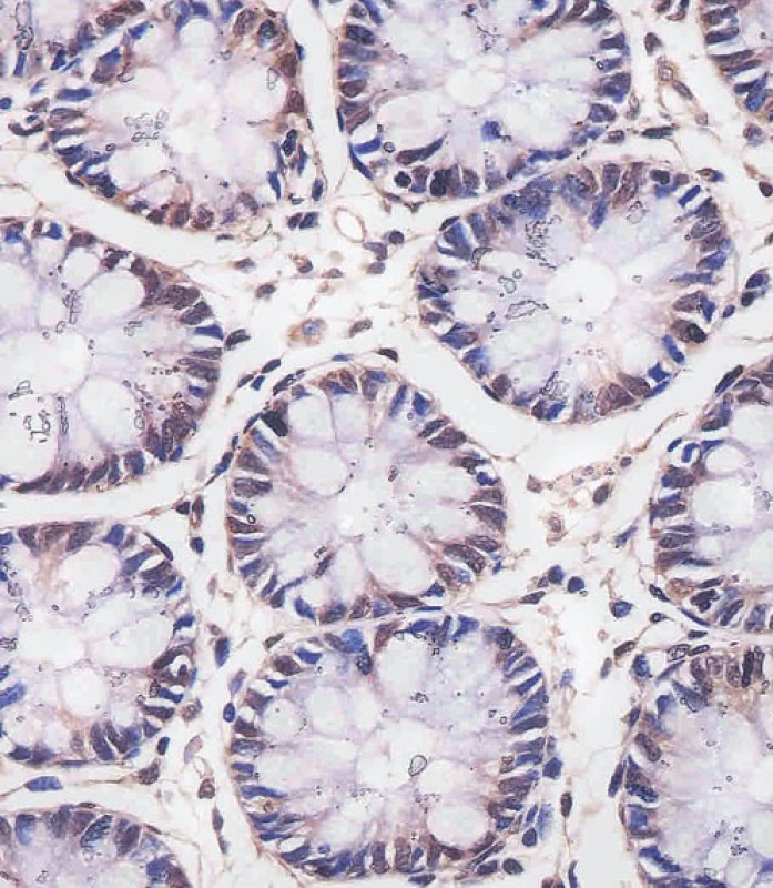 Mouse Monoclonal Antibody to MBD2
