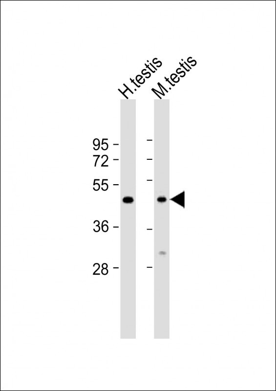 Rabbit Polyclonal Antibody to BSCL2 (N-term)